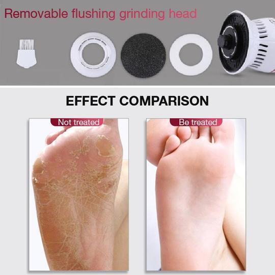 Heel Pro Electric Callus Remover